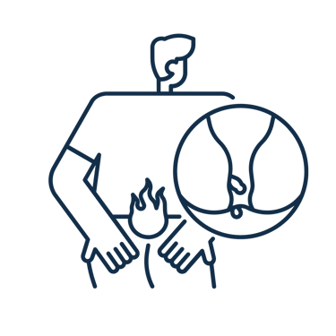 Hemorroidas e Doença hemorroidária