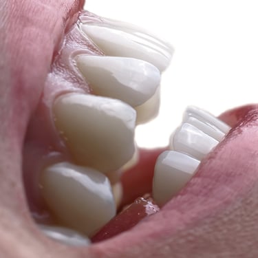 odontologinė fotografija