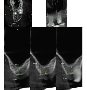 CBCT Scan Report