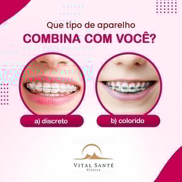 aparelho ortodôntico recreio, aparelho dentário recreio