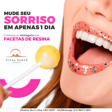 faceta de resina, dentista no recreio dos bandeirantes, dentistas no recreio, dentistas recreio