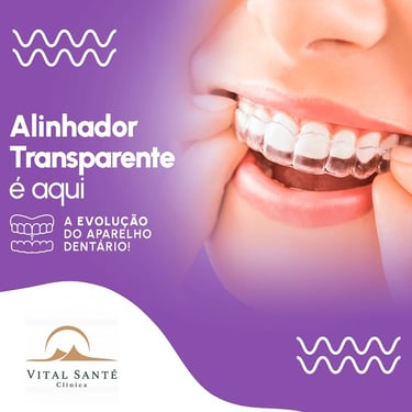 aparelho invisível recreio, alinhador invisível recreio, aparelho transparente recreio 