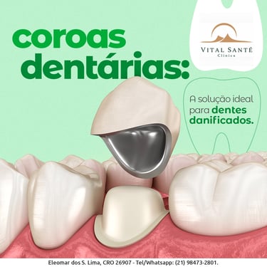 prótese dentária, coroa dente, dentista recreio