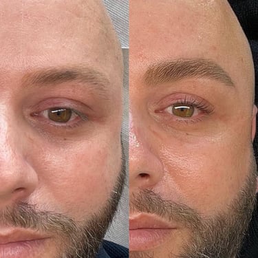 Résultat avant-après d'une restructuration sourcils 