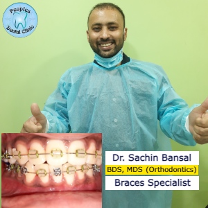 dr. sachin bansal senior orthodontist at peoples dental clinic greater noida