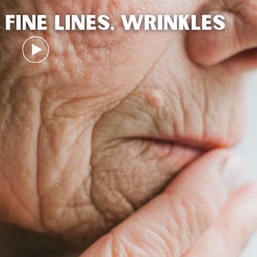 a woman with afine lines, wrinkles