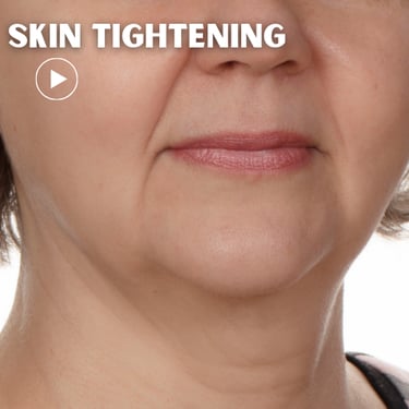 a woman with losse skin