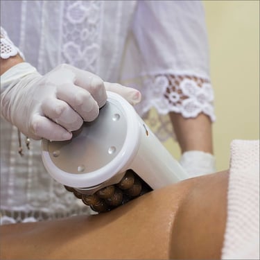 tratamiento anticelulitis ibiza