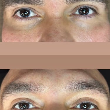 Antes y despues de micropigmentación ceja hombre