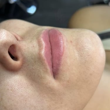 Antes de micropigmentación labios mujer