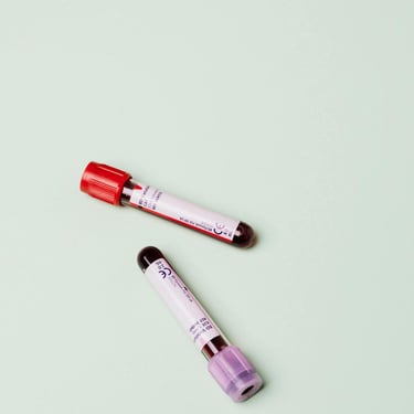 Tubos de muestras de sangre rojo y morado