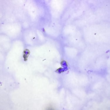 Trofozoito de Giardia Lamblia 