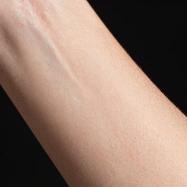 Macro close-up of the same unretouched skin area showing highly improved density, smooth texture, and refined tone under neutral clinical lighting.