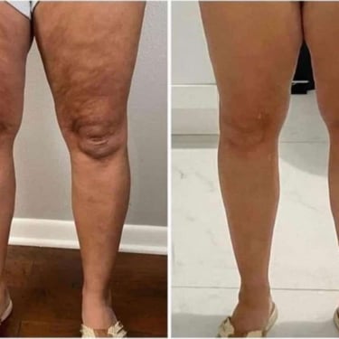 0001-legs-customer-change