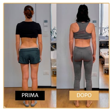 Risoluzione lombalgia cronica post-cesareo donna di 40 anni Performa Specialists by Dott. Rossin