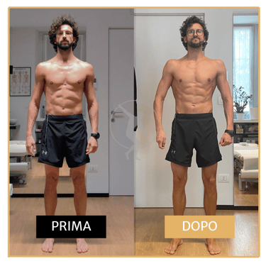 Miglioramento Scoliosi in uomo di 40 anni Performa Specialists by Dott. Alessandro Rossin