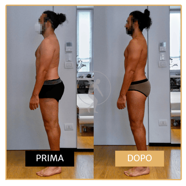 Risoluzione lombalgia cronica uomo di 40 anni Performa Specialists by Dott. Alessandro Rossin