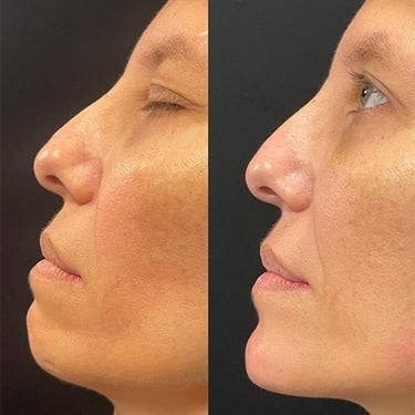 estetica avancada queixo viva clinica integrada raphaella autran