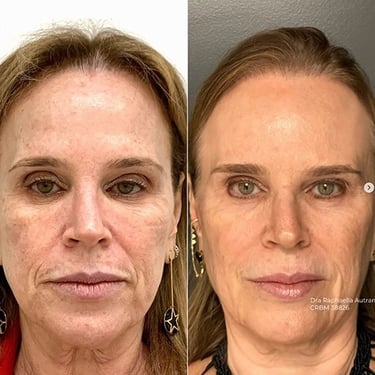 estetica avancada facegloss viva clinica integrada raphaella autran