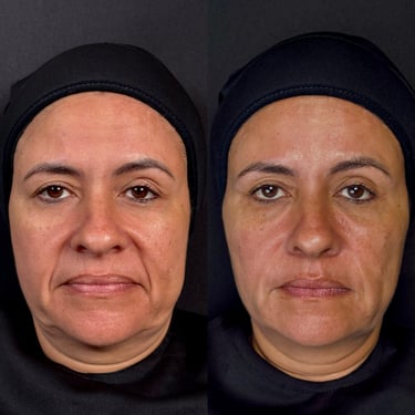 estetica avancada facegloss viva clinica integrada raphaella autran