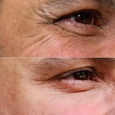 preenchimento pes de galinha viva clinica integrada raphaella autran