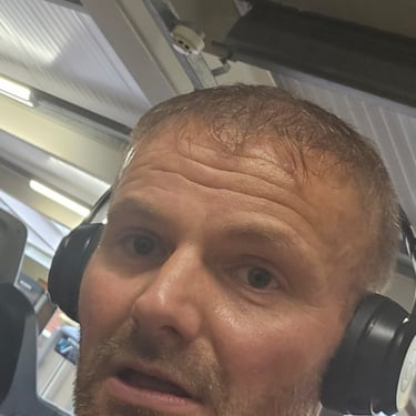a man before his anti wrinkle injections treatment