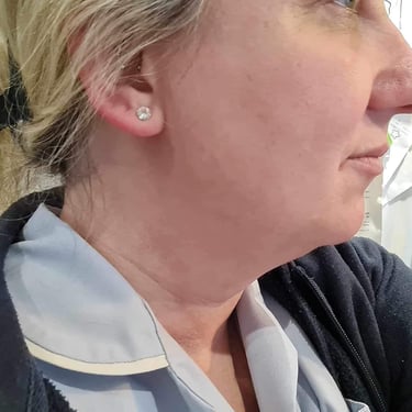 a women after her weight loss treatment