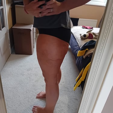 a women after her weight loss injections treatment