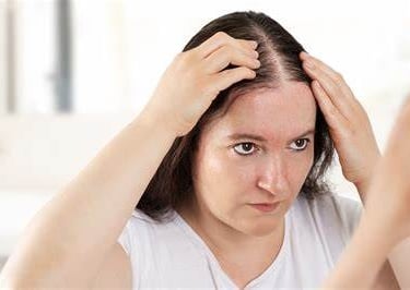 woman looking in mirror losing hair