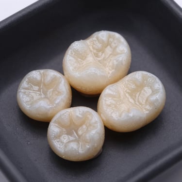 coronas de zirconia