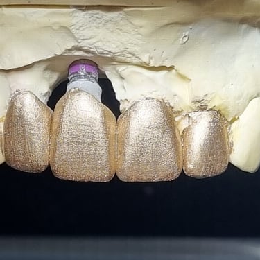 fotografia para observar anatomía en dientes anteriores