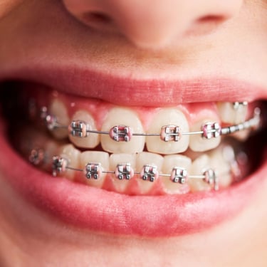 Boca con brackets sonriendo