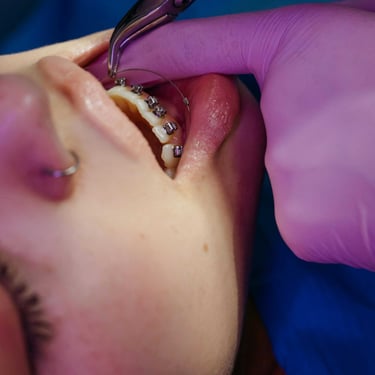 Persona en tratamiento dental de brackets