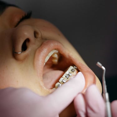 Persona con brackets en limpieza dental y revisión dental
