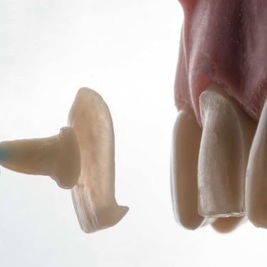 Placas coronillas para dientes