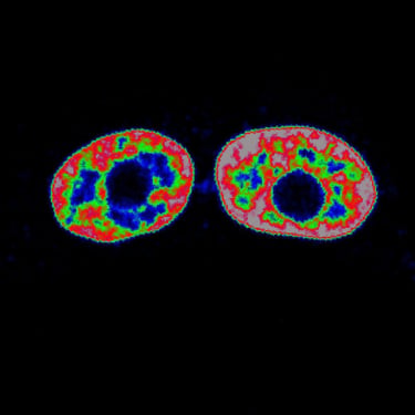 Microscopic view of two biological daughter cells presenting toroidal nuclei