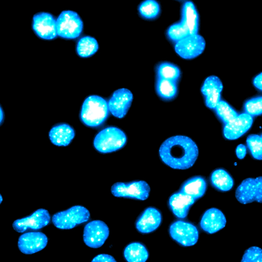 Fluorescence microscopy image showing glowing blue DAPI-stained cell nuclei, normal and toroidal.