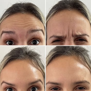 a woman with a lot of wrinkles on her face