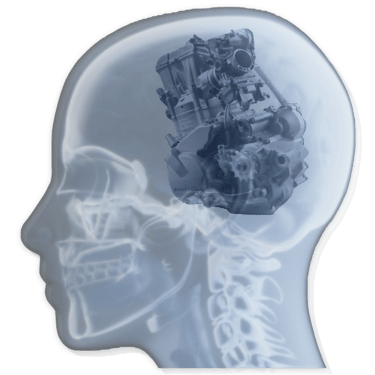 GJ Silver Ride to Rise Coaching engine within a human skull x-ray