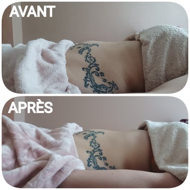 avant/après drainage renata franca grenoble