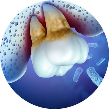Soin naturel parodontite jet dentaire ozone Aquolab hygiene-precision.com