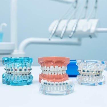 Traitement orthodontique pour adultes hygiene-precision.com