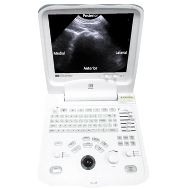Diagnostic Ultrasound Northampton