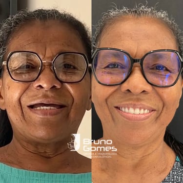 Prótese dentária em Barra do garças no centro odontológico Bruno Gomes