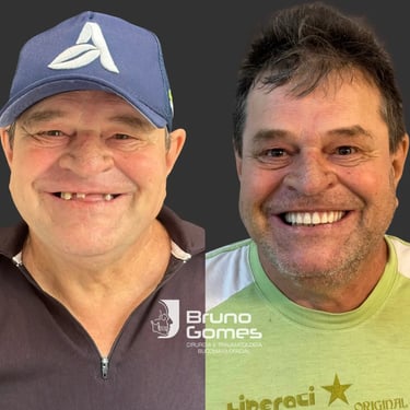 Prótese dentária em Barra do garças no centro odontológico Bruno Gomes