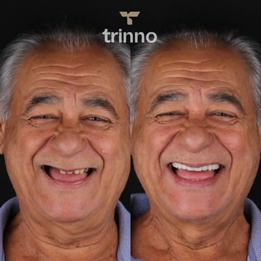 Tratamento de Implantes dentários antes e depois na Trinno odontologia.