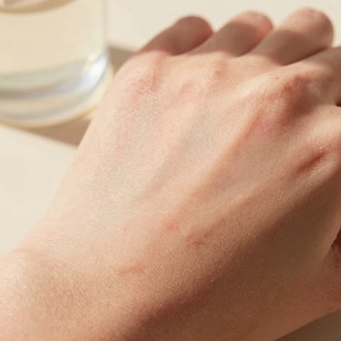 Extreme close-up of dehydrated skin texture with slight redness, soft natural morning light, warm editorial style