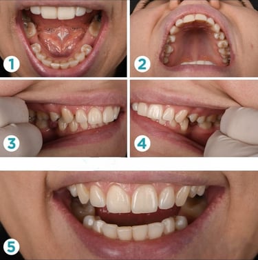 esempi di foto dei denti per preparazione preventivo per cure dentali