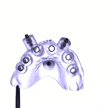 Guía quirúrgica impresa en 3D utilizada para cirugía de implantes dentales guiada