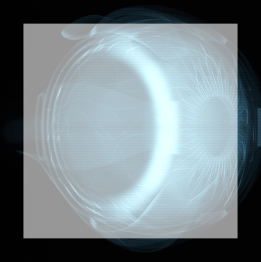 Flashes & Floaters a picture of an x-rayed eye